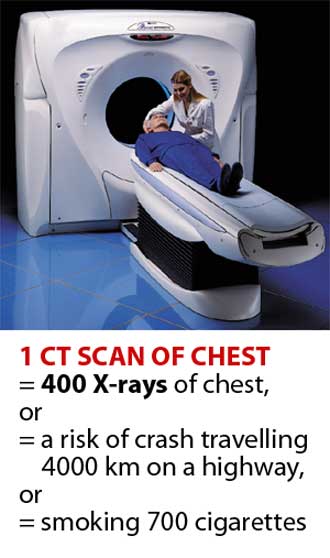 ct-scan1