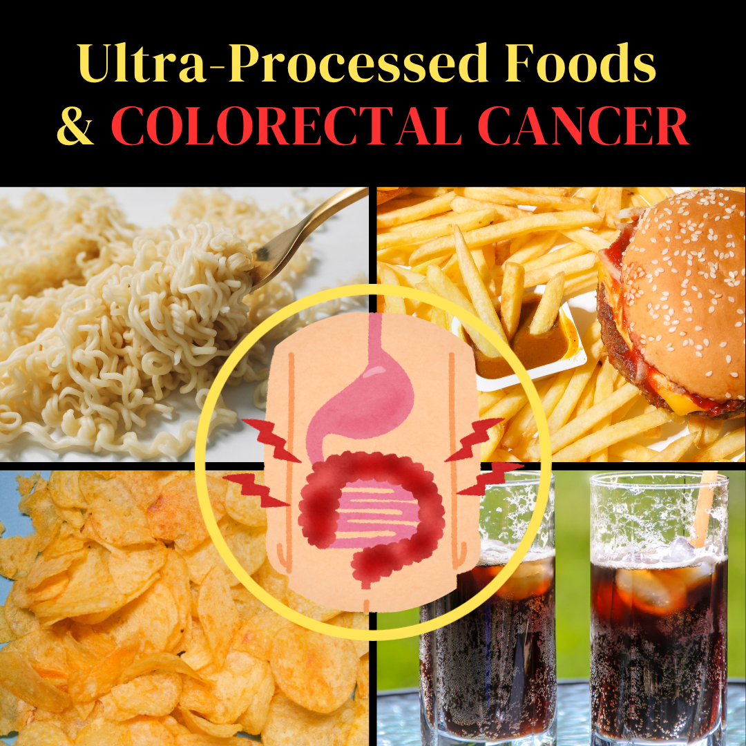 The Link between Colorectal Cancer and Ultra-Processed Food
